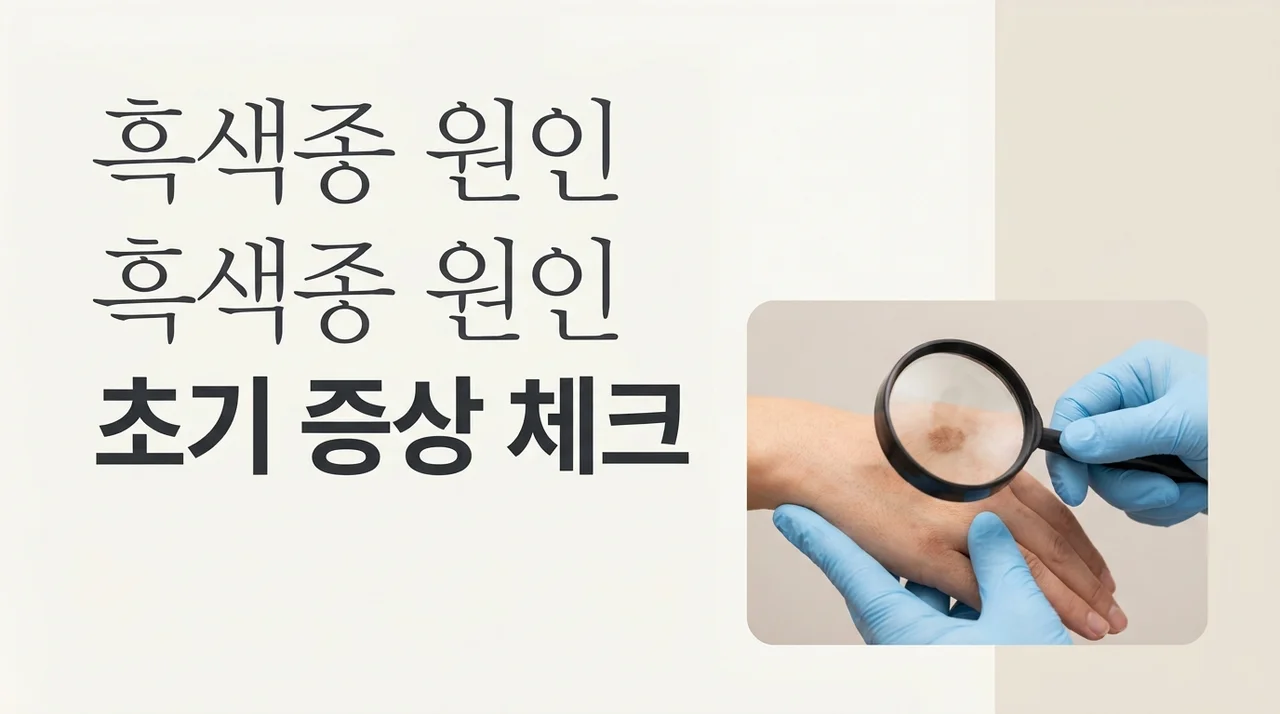 흑색종 원인과 초기 증상, 단순한 점과 구별하는 확실한 방법